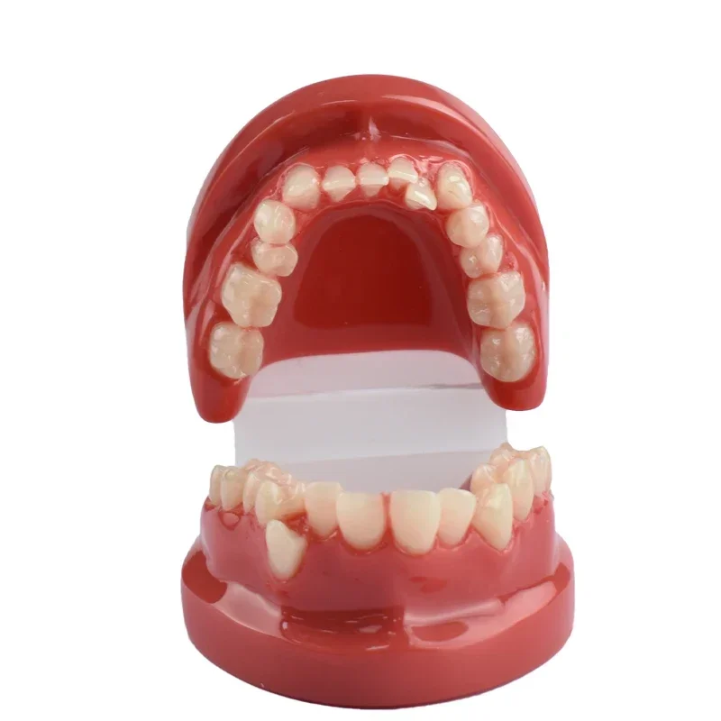 

Dental Teeth Malocclusion Model Resin Teeth Model Students Practice Teaching Training Communication Model Oral Tooth Models