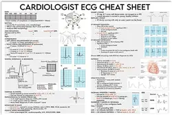 Vintage Ecg Knwoledge Metal Sign Cardiologist Ecg Cheat Sheet Study Infographic Posters Office Club Home Wall Decor Plaque 12x18