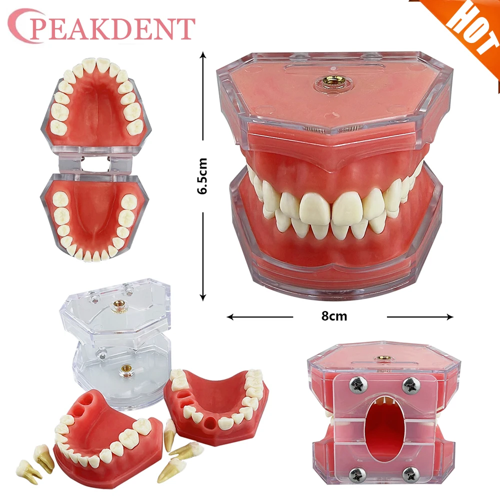 

Transparent Dental Model Tooth Root Visible Dental Typodont Model With Removable Teeth Medical Students Research Study Model