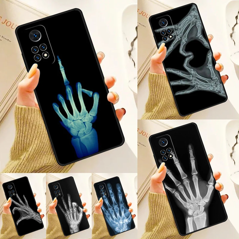 X-ray Hand Bones Case For Samsung Galaxy S24 Plus S23 S20 S21FE Lite S22 Ultra Note 20 S8 S9 S10 Phone Coque