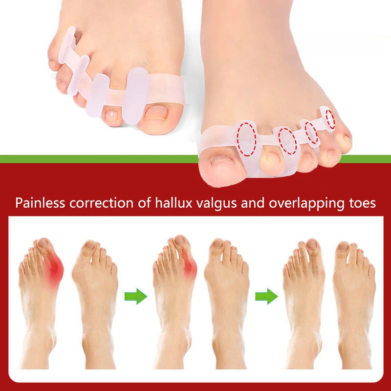 زوج واحد من فاصل أصابع القدم، مادة مصحح الورم المناسبة، فواصل فرد الجل الناعم