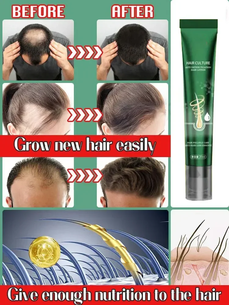 Produk penumbuh rambut, minyak penumbuh rambut cepat tumbuh efektif kebotakan esensial memperbaiki kemiringan Anti melahirkan