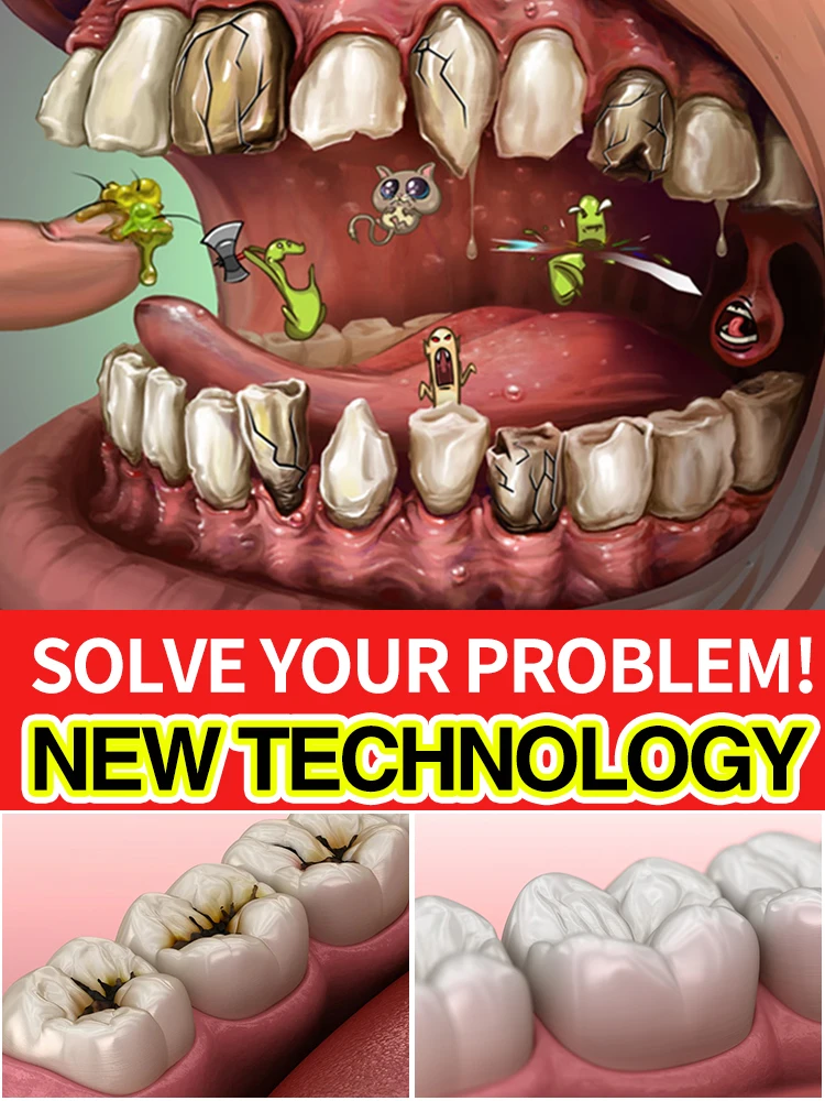 

Tooth decay repair, tooth cavity, toothache, quick solution