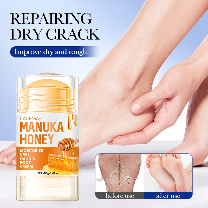 

Медовый крем для ног, крем для трещин, пяток, ОТШЕЛУШИВАЮЩИЙ ПИЛИНГ для ног, удаление мозолей и омертвевшей кожи, уход за ногами, увлажнение, 40 г