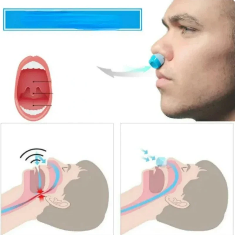 2 in 1 Anti Snoring Amp Air Purifier Relieve Nasal Congestion Snoring Device Ventilation Anti-snoring Anti Snore Nose Clip