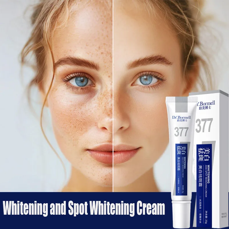 

Powerful Spot-removing Whiten Cream Brighten Skin Fast Eliminates Melanin Pigmentation Melasma Dark Spots Moisturize Cream