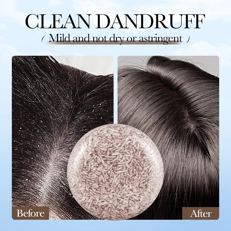 صابون الشعر SADOER Polygonum Multiflorum شامبو صلب للتحكم في الزيت ومضاد للقشرة والتطهير العميق وإصلاح شامبو الشعر الجاف التالف #6