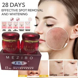 Original Whitening Freckle Face Cream Moisturizing Remove Freckles Age Spots Melasma Pigment Melanin Acne Spot Skin Care