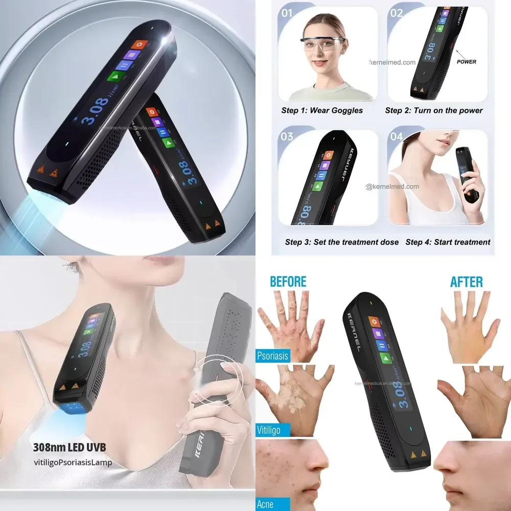 

Mini Portable Psoriasis Vitiligo Treatment Lamp CN-308P 308nm LED Excimer Pen Small Size High Power