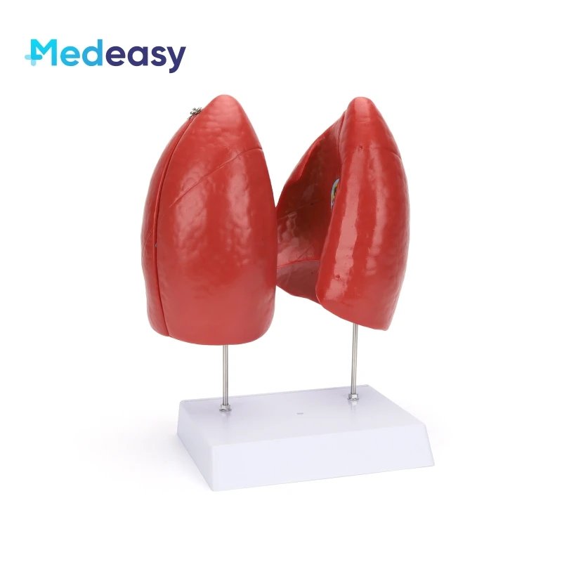 Detachable Human Anatomy Lung Anatomical Model