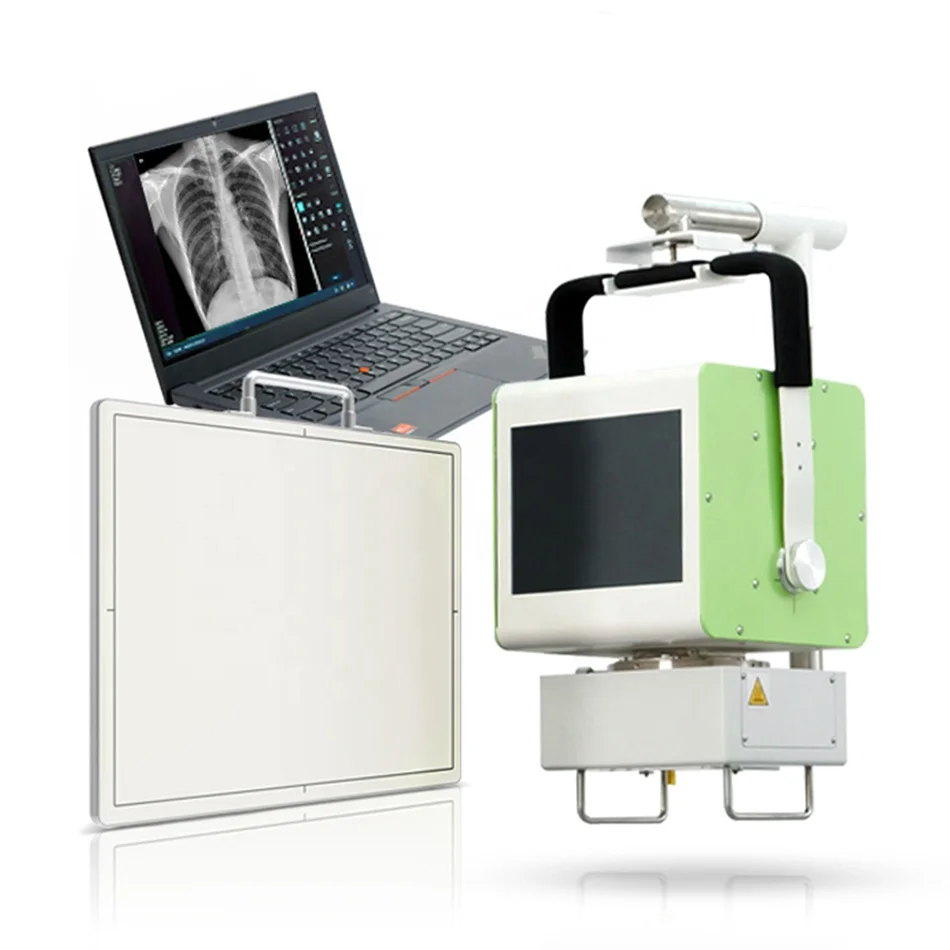 100mA Xray DR 5kW Unidade de raio X Equipamento de radiologia médica Máquina portátil de raio X digital móvel