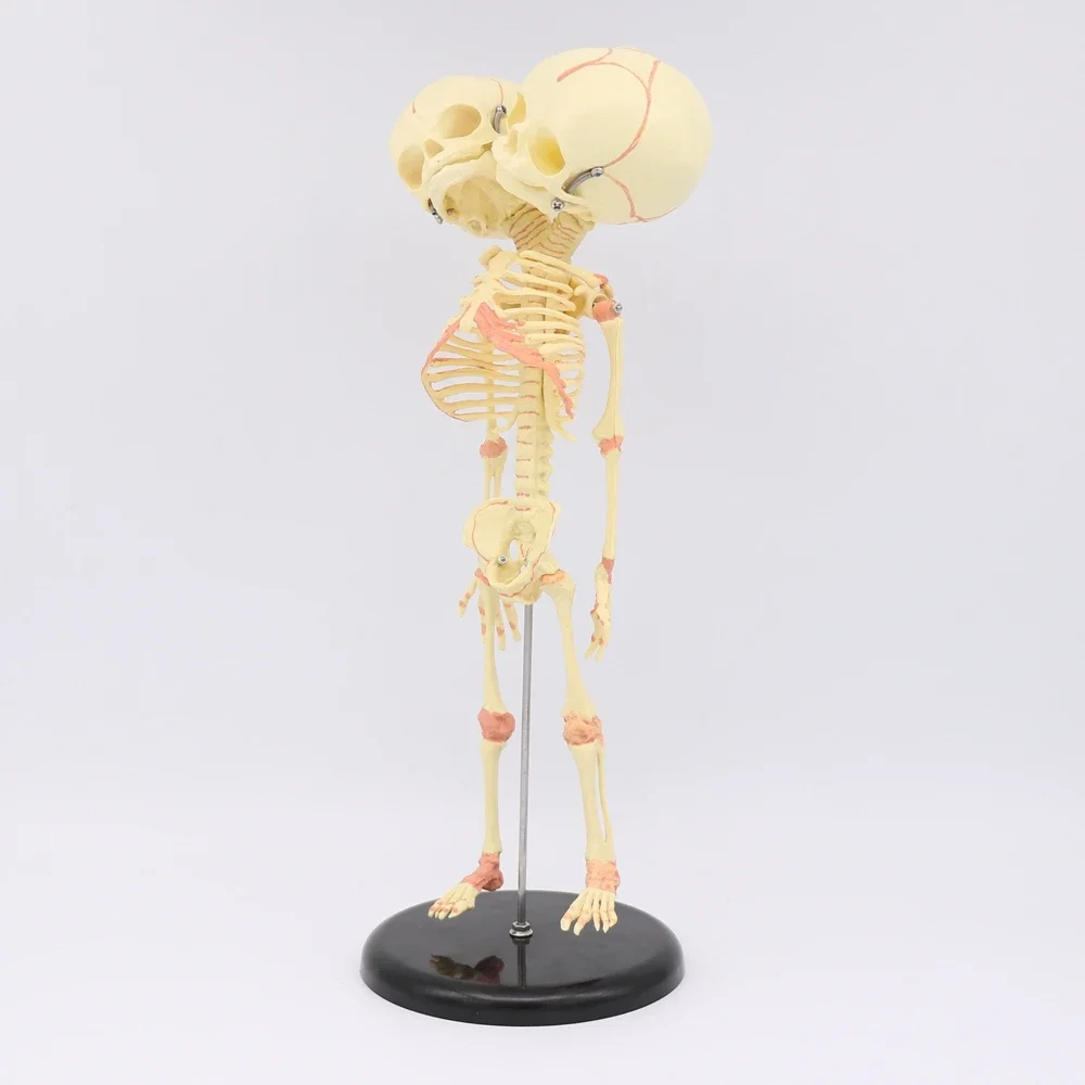 35cm Human New Born Double Head Baby Anatomy Skull Skeleton Anatomical Brain Anatomy Education Model Anatomical Study Display