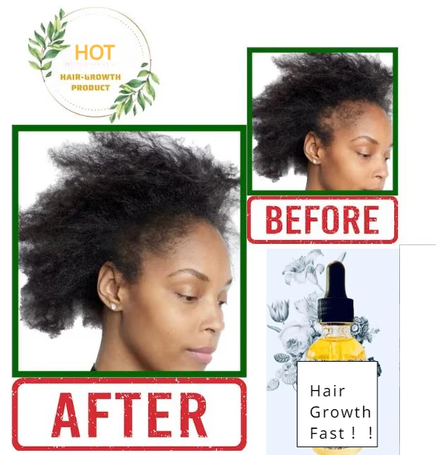 Hair Growth Oil - Advanced Rosemary Oil for Hair Growth - Unique Blend of Oil for Dry Damaged and Growth - 7+