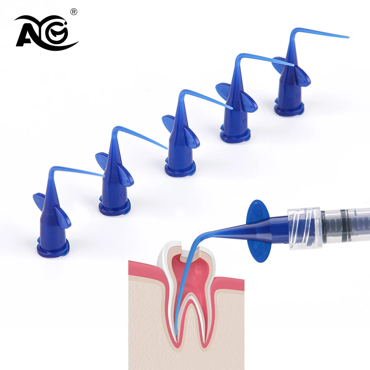 AG DENGT 50/100/200Pcs sbiancamento dei denti punte per irrigazione dentale punta per siringa monouso dentale blu punte per irrigazione dentale