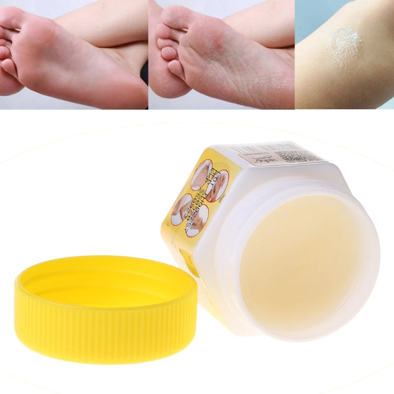 20g Natural Banana Oil Moisturizing Cracked Heel Balm Foot Hand Skin Repair Cream Anti-Drying Smooth Dead Skin Removal Ointment