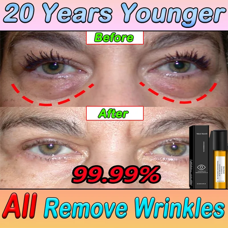 

Anti-wrinkle Oxys Cream Wrinkle Face Cream Anti-Aging Face Lift Remove Eyes Bag Wrinkles Skin Product Remove All Wrinkles