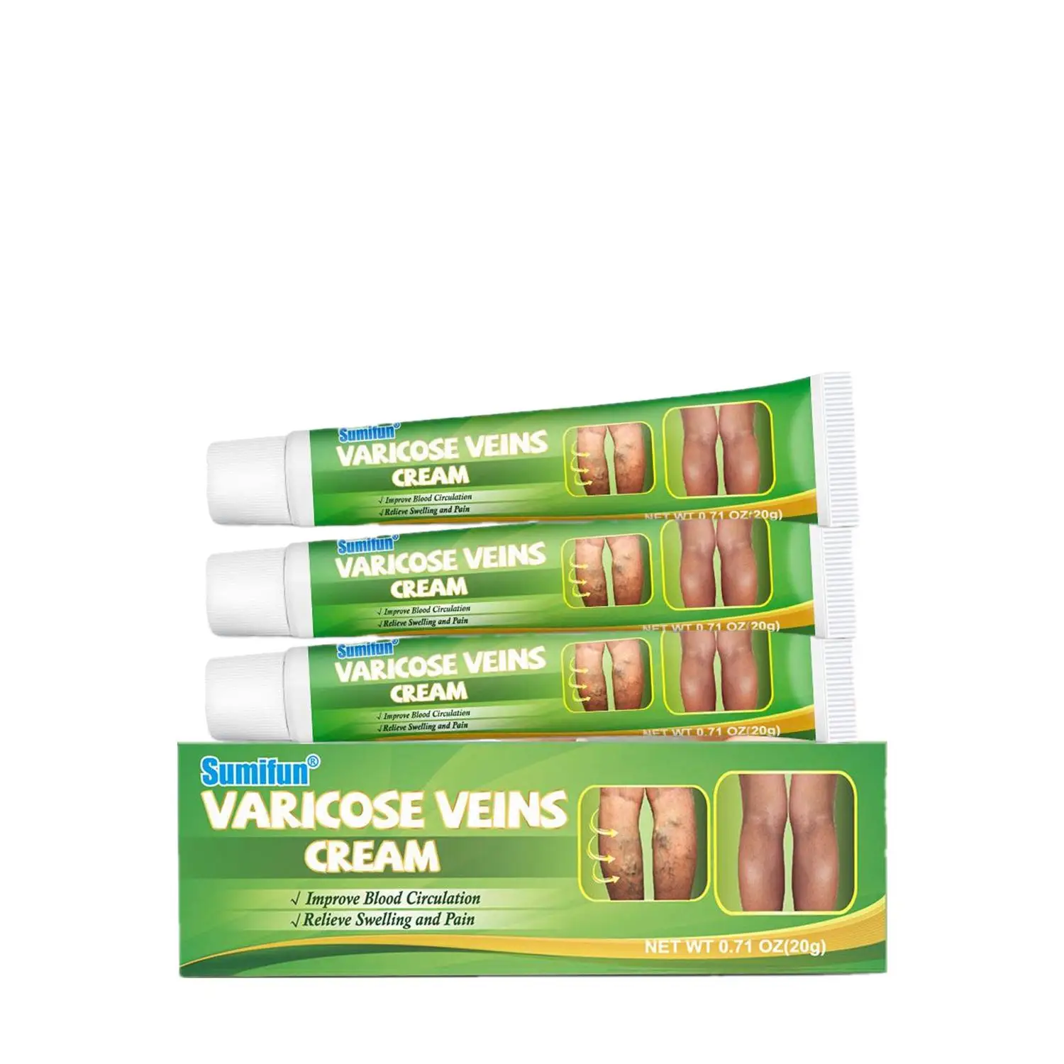 3 Stuks Spataderen Behandeling Crème Effectief Verlichten Benen Verwijde Vasculitis Flebitis Natuurlijke Formule Zalf