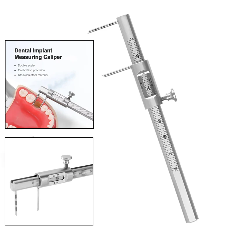 

Стоматологический ортодонтический скользящий штангенциркуль 0-80 мм, измерительный прибор для зубного имплантата, линейка, штангенциркуль из нержавеющей стали