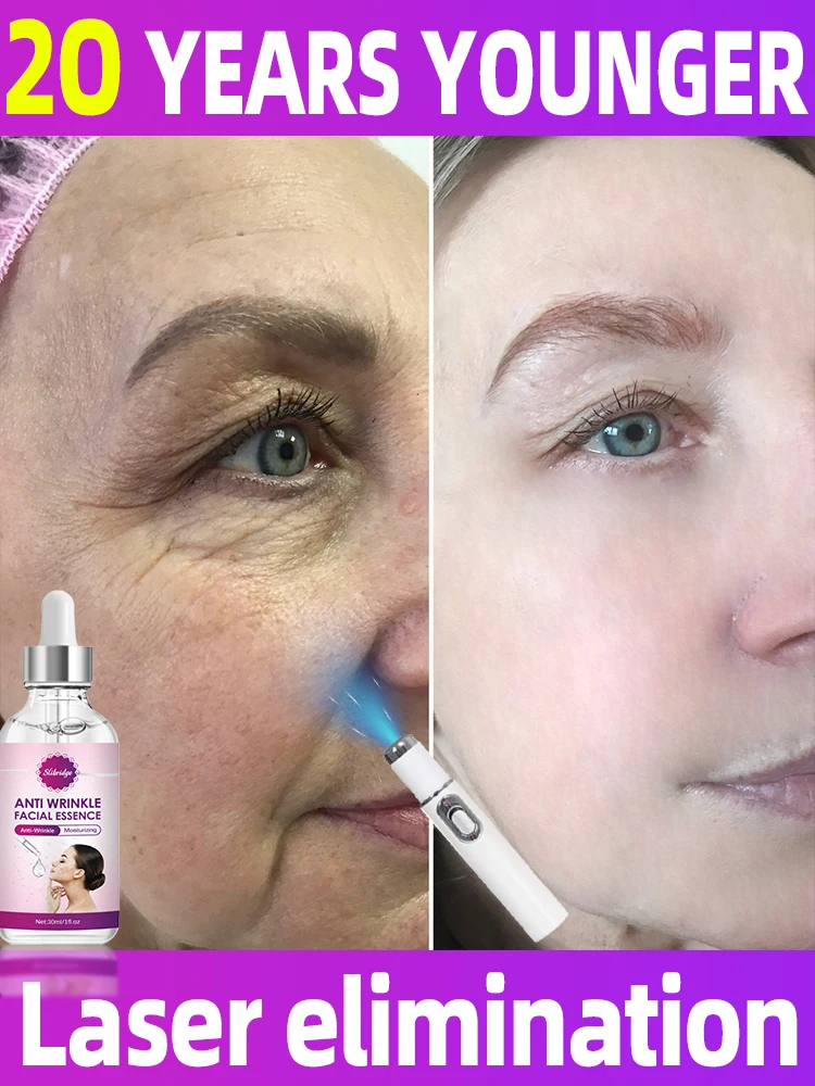 Laser Product To Solves wrinkle troubles