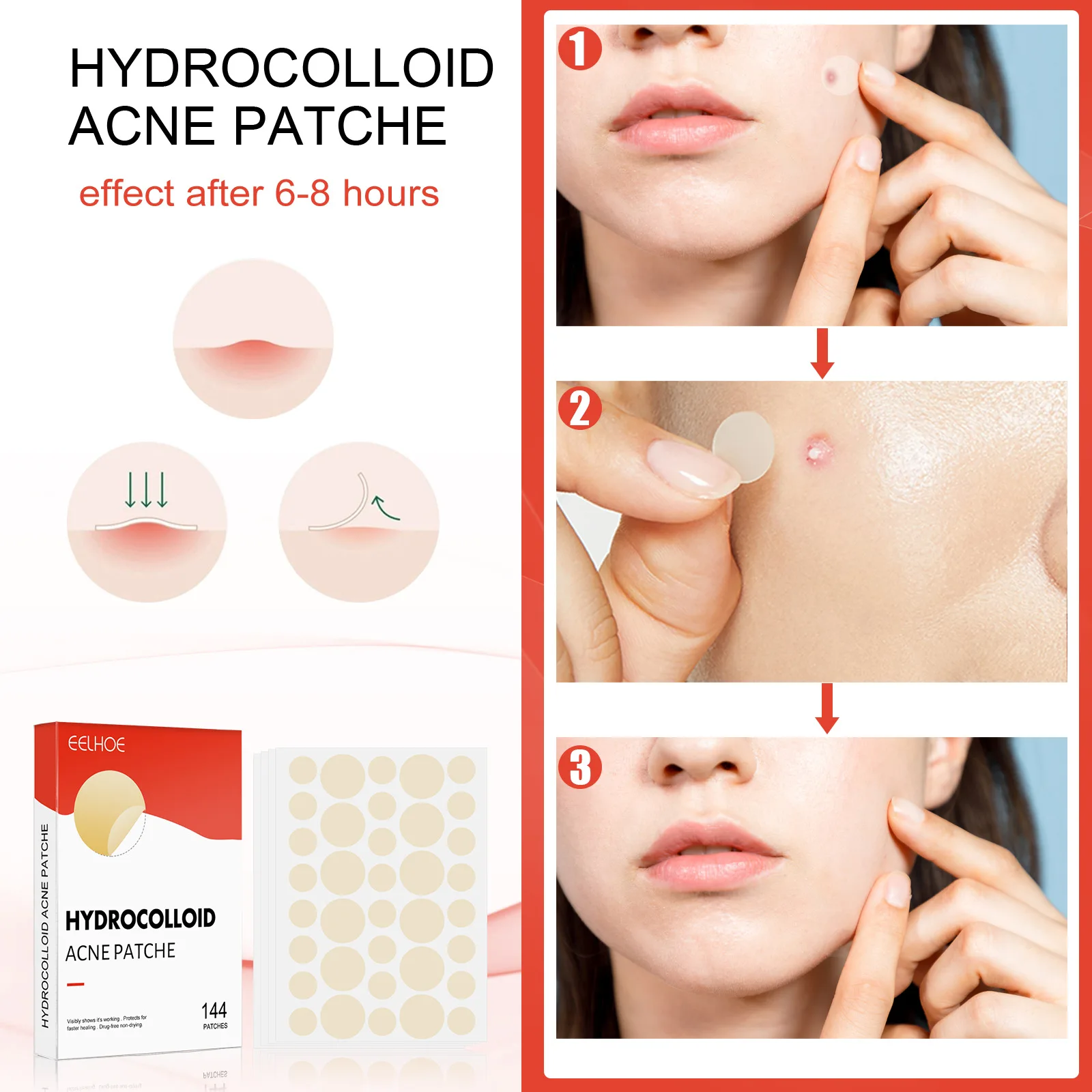 Onzichtbare Acne Patches Verwijderen Puistje Anti-Acne Hydrocolloïde Pleisters Vlekken Markeren Concealer Reparatie Sticker Waterdichte Huidverzorging