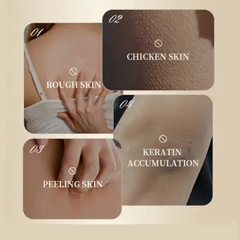 8 best sales جلد الدجاج - №3