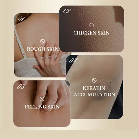 8 best sales kycklingskinn - №3