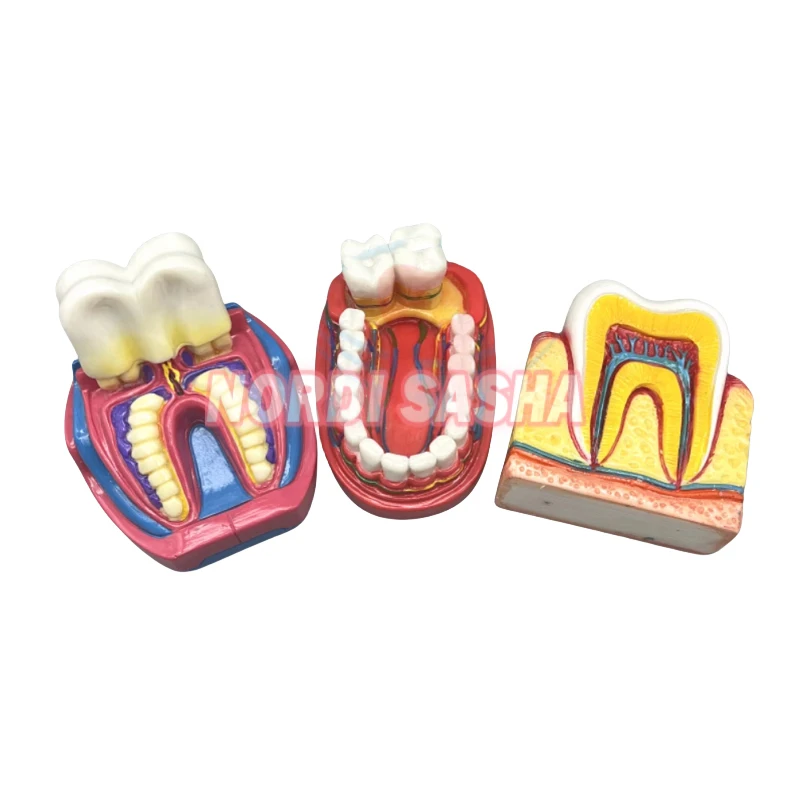 

1Pcs/Box New Dental Clinic Ornaments 6 Times Big Teeth Model Doctor-patient Communication Teaching Model 3 Types