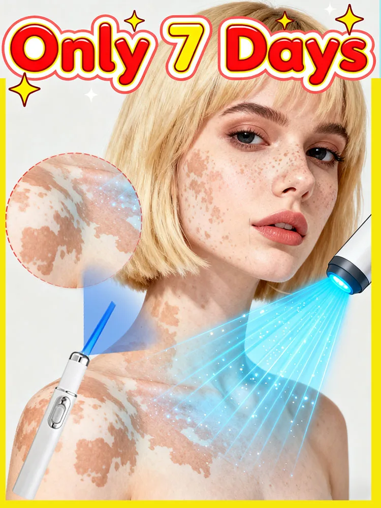 

2025 upgraded blue light pen home use Gentle Solve White spots protect your skin care tools