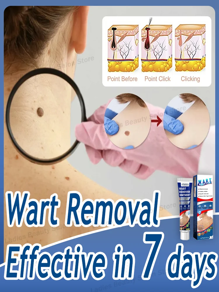 Let you live a comfortable life without warts, suitable for all and effective