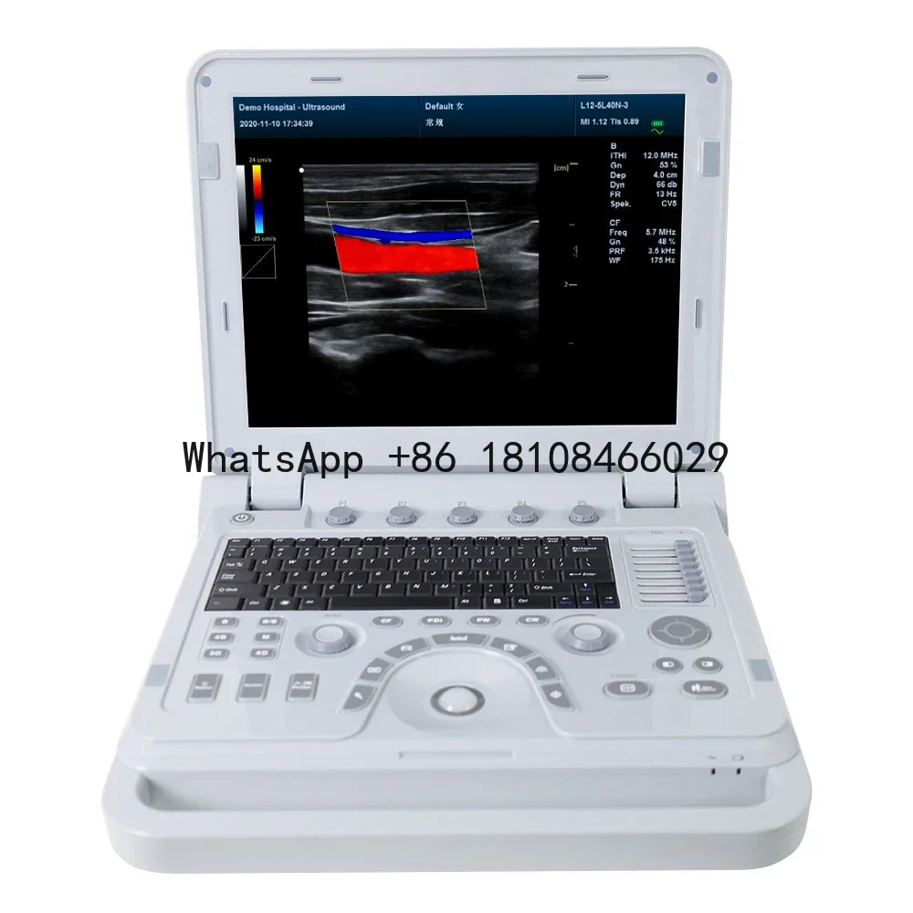 

CONTEC CMS1700B-VET Veterinary high resolution Ultrasound System animal vet color doppler