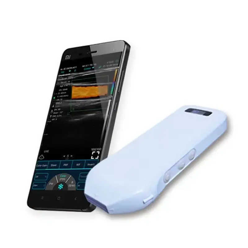 192E 10-14MHz Linear Wifi Wireless Color Ultrasound Doppler Linear   Probe Support iOS Android Windows Free Suitcase