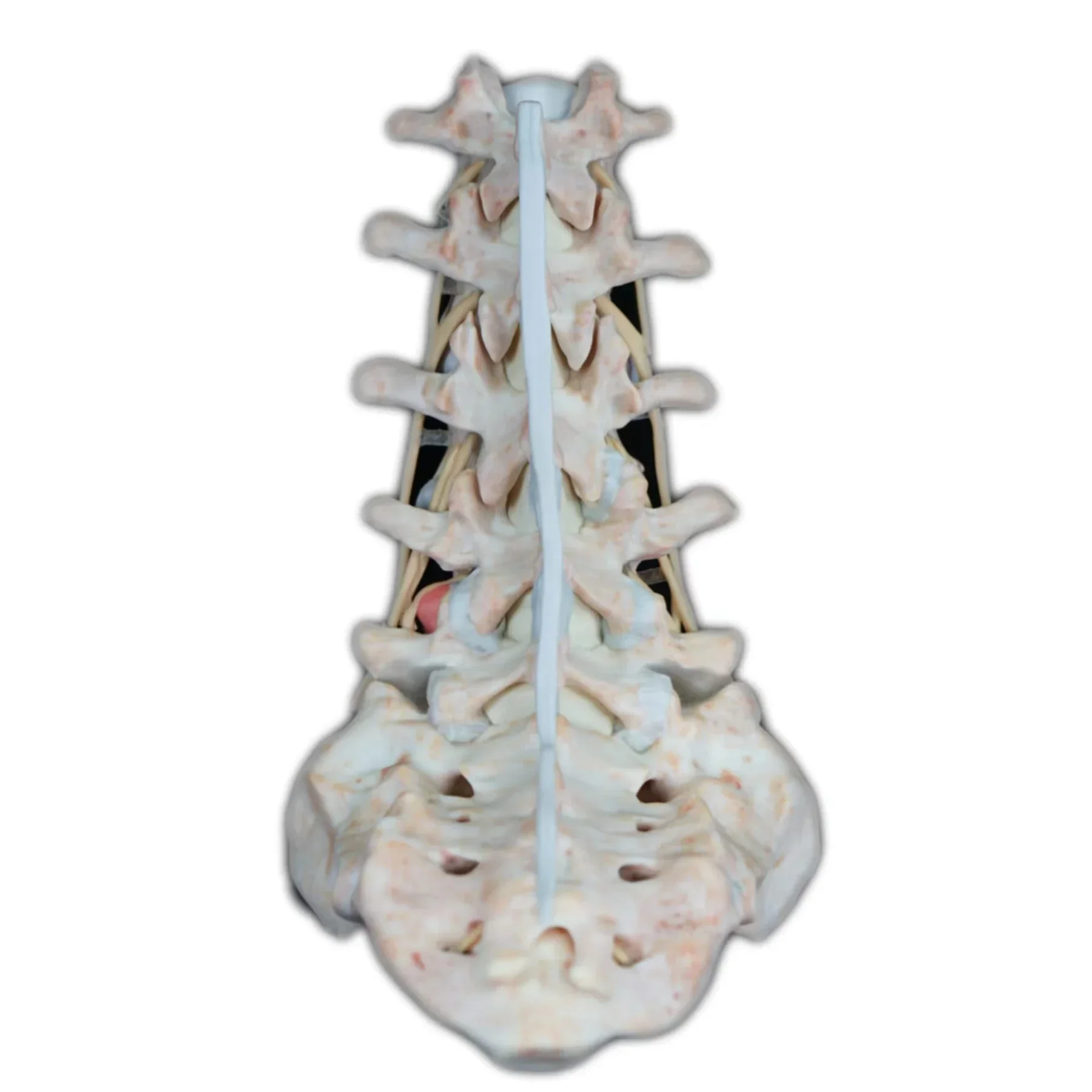 

Digital Human Model Lumbar Disc Herniation Model Medical Anatomical Teaching Tool for Medical Education