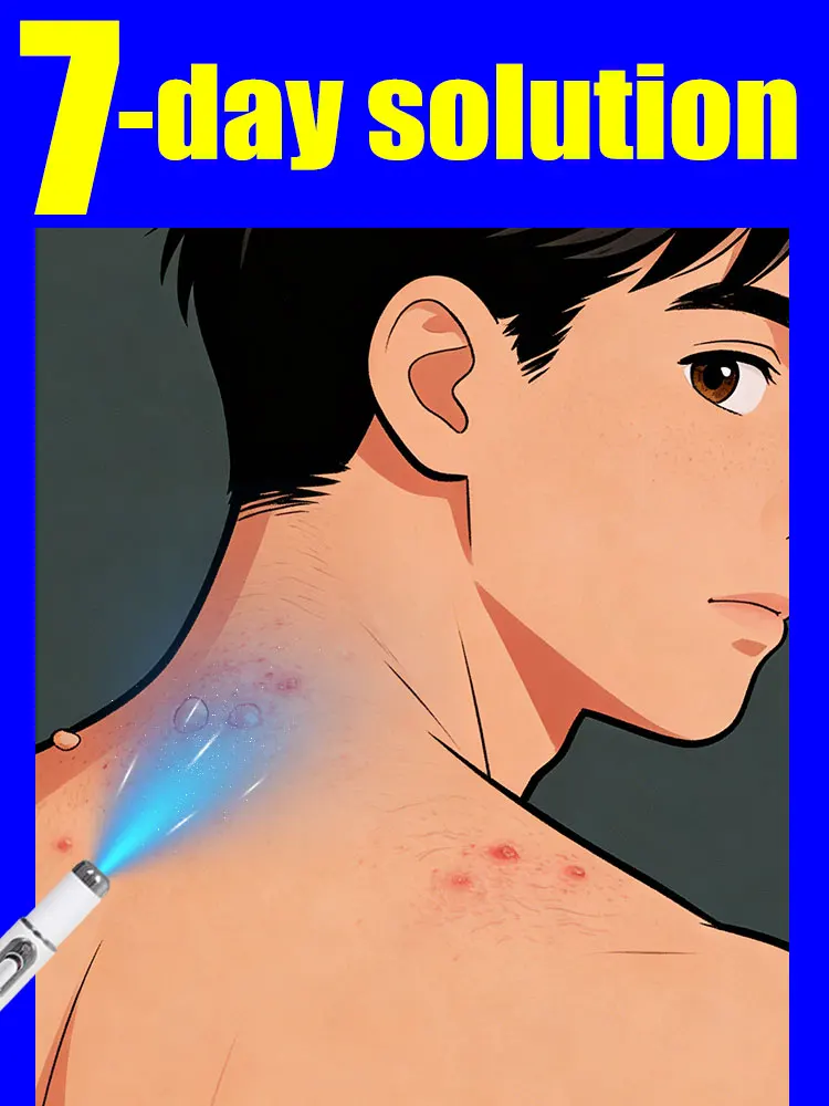 

Популярный выбор: лампа для удаления бородавок синим светом. Инструмент для уборки.