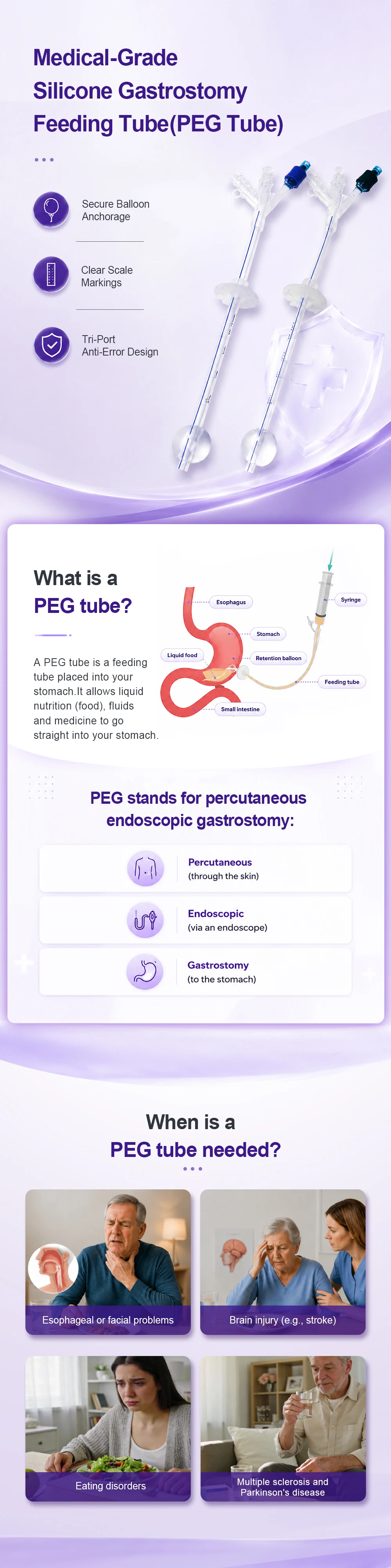 Califed Silicone Gastrostomy Tube Multi Functional Connector X-Ray Medical PEG Tube With Balloon Gastrostomy Surgical Equipment