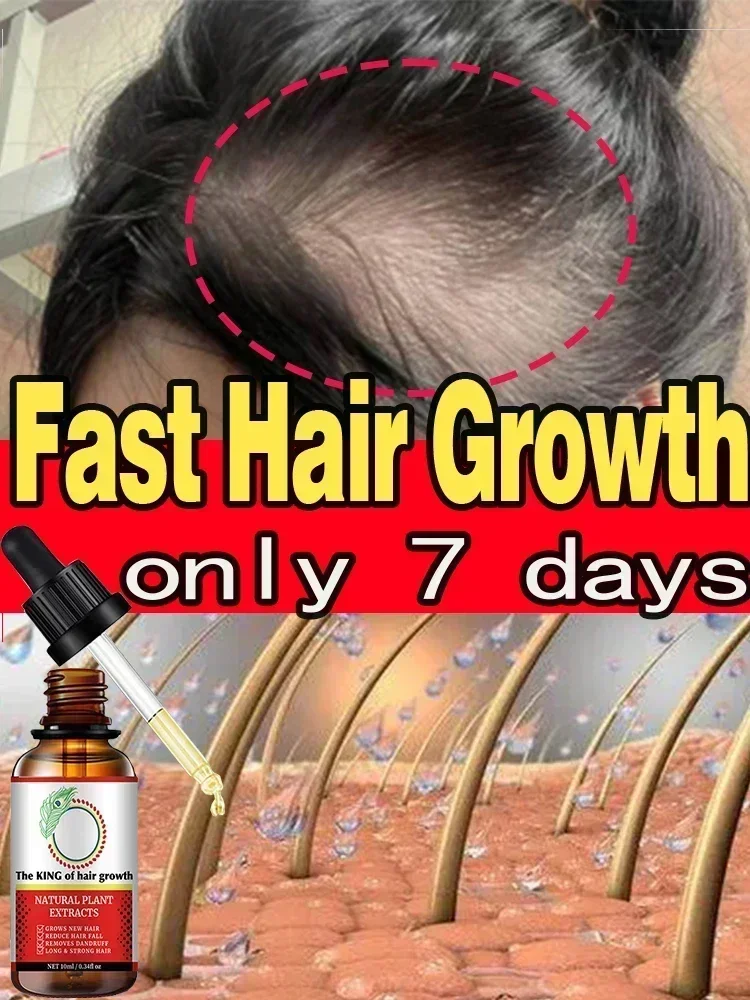 

Fast Hair Growth Oil Baldness Repair Hereditary Hair Loss Postpartum Loss Seborrheic Hair Loss Oil Fast Growth beauty products