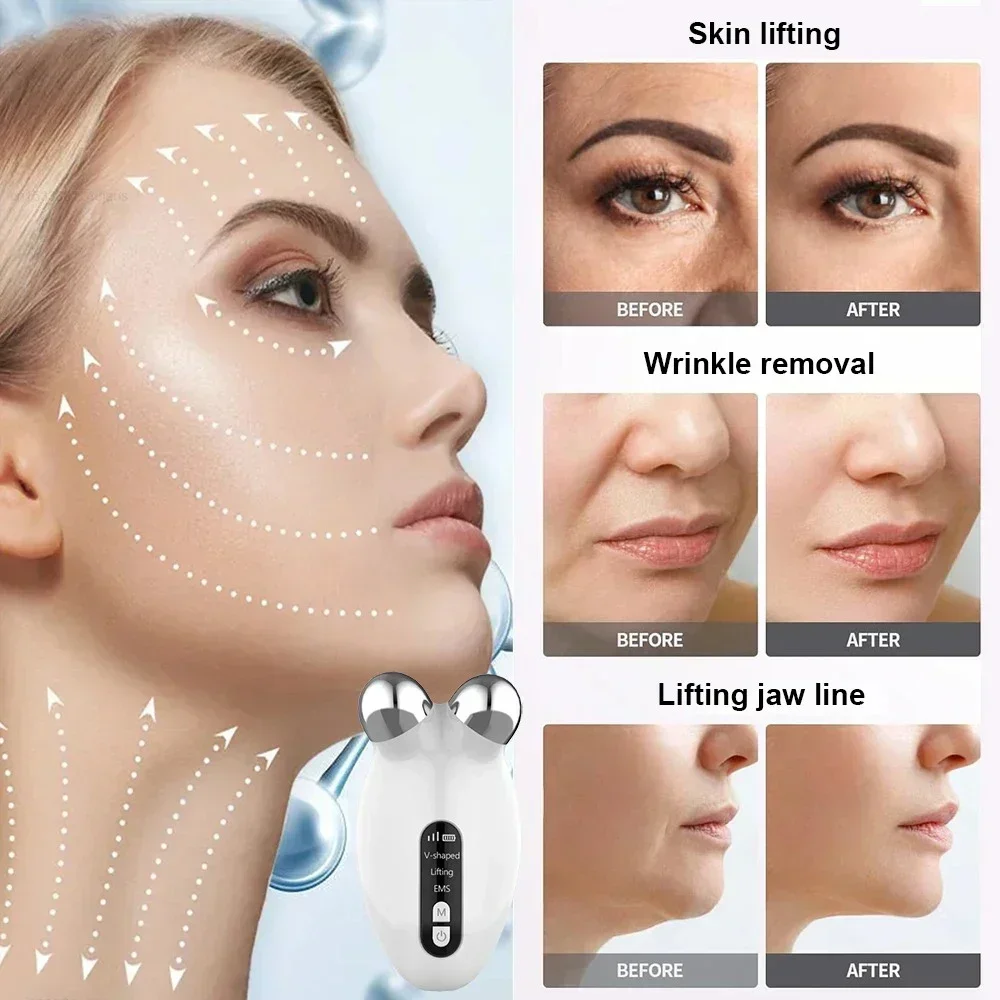 Mini EMS Schoonheidsinstrument Gezichtsmassager RollerFace Afslanken Delicate contour Lifting Verstevigend Lift gezicht en straffen de huid