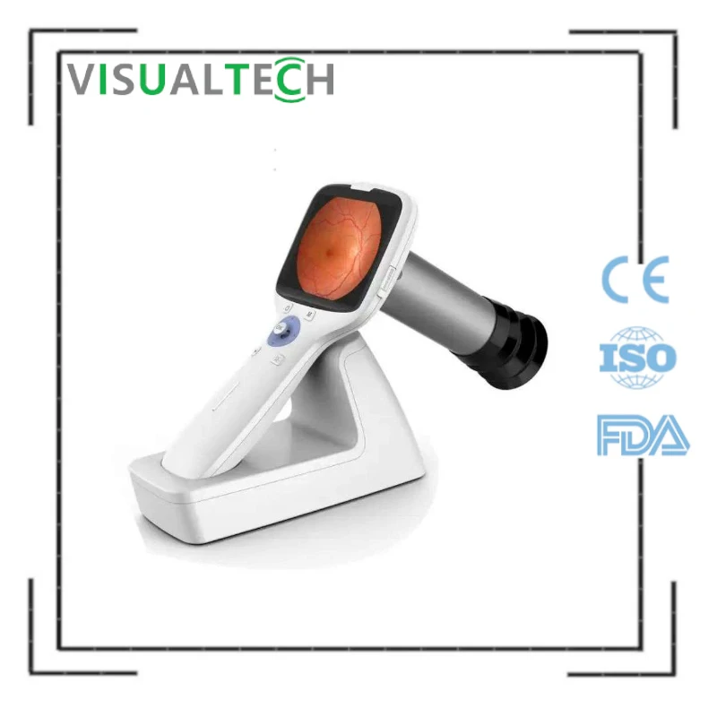 Ophthalmic Equipment Factory Best Price MS-01 Handheld Non Midiatric Fundus Retinal Camera