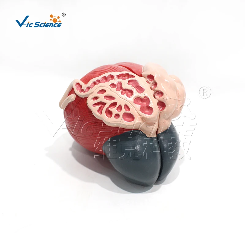 Medical Science human Bladder enlargement anatomy model