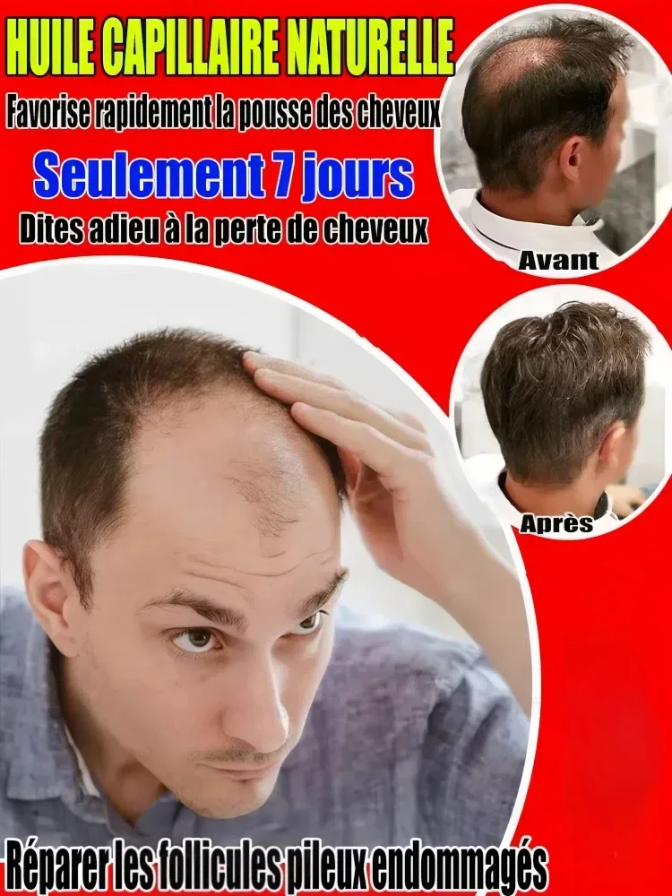 Reverse gray hair, restore youth, completely treat gray hair, and get rid of troubles