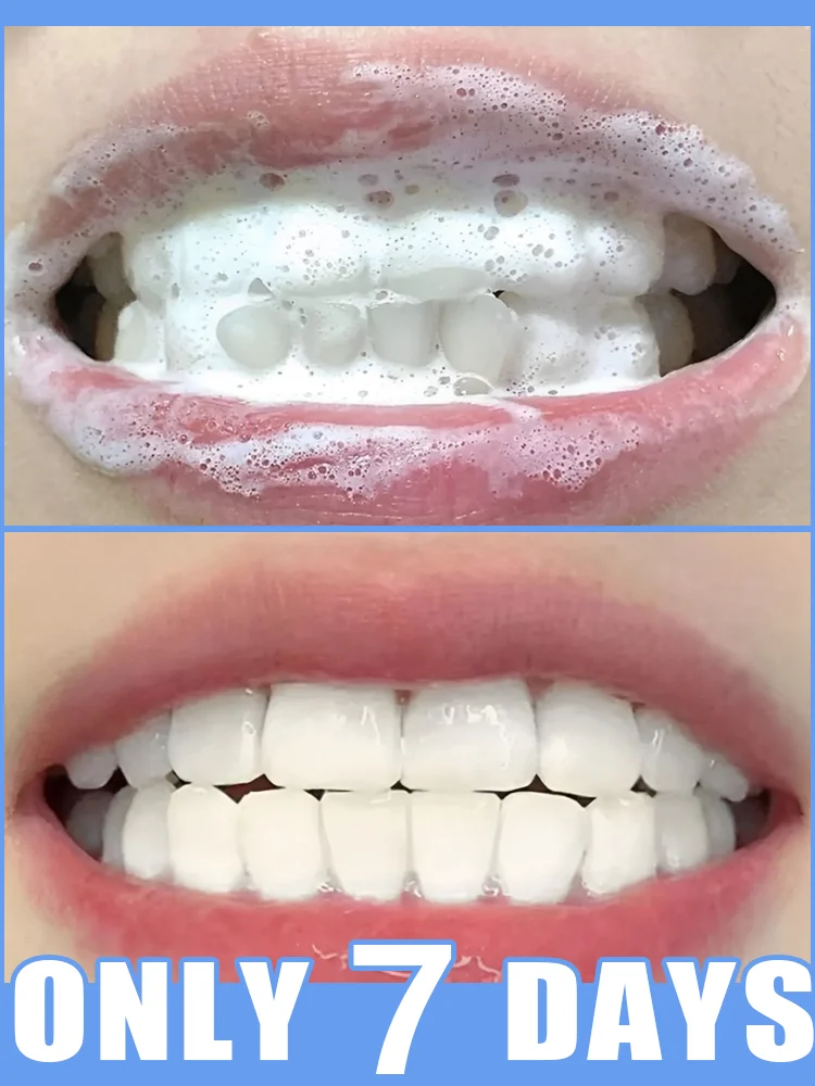 

Anti-caries oral serum: 99.9% gum repair and bacteria removal
