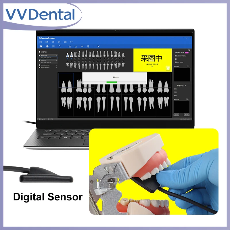

Портативный дентальный рентгеновский датчик VVDental с 2-летней гарантией, интраоральная система RVG X-RAY, датчик HDR для получения изображений