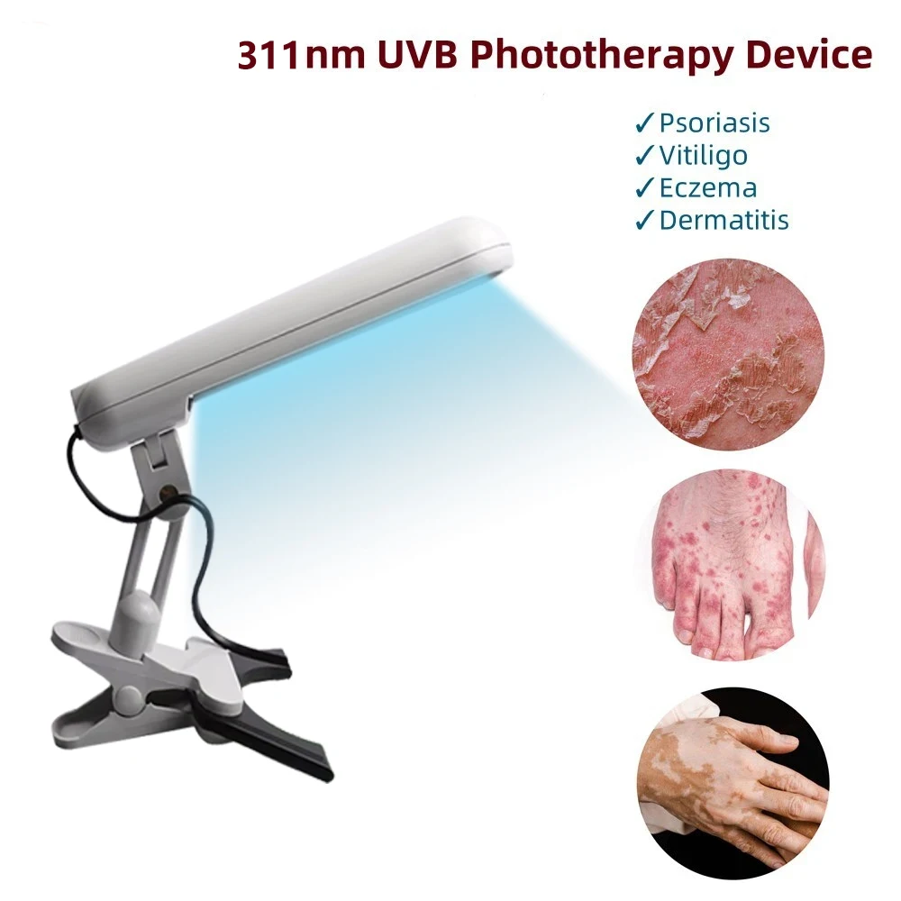 

UV 311nm Ultraviolet Phototherapy Device UVB To Treat Vitiligo, Psoriasis, White Spots And Skin Diseases