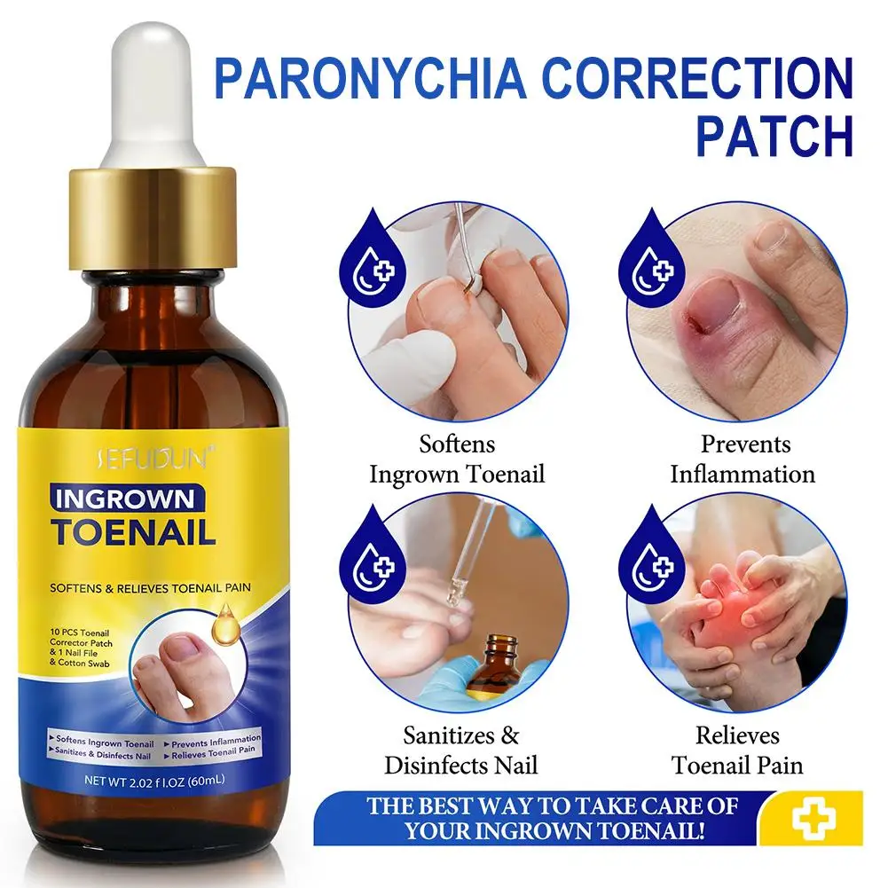 مجموعة ملصقات تصحيح الأظافر المقاومة للماء لتصحيح أظافر القدم الغارزة، علاج الداحس، استعادة العناية بالأظافر #3
