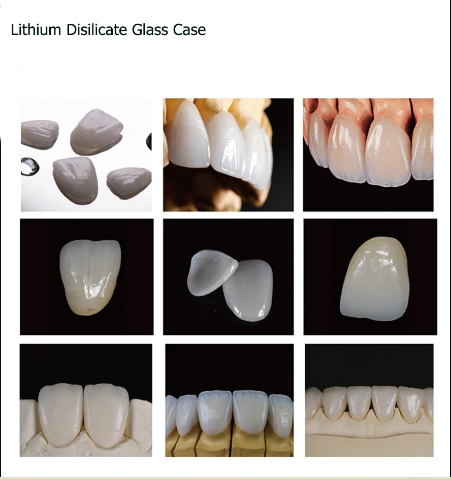 Zielony 4 szt. B40 Dental dwukrzemian litu szklany blok ceramiczny CAD CAM Emax dla Sirona Cerec Inlab