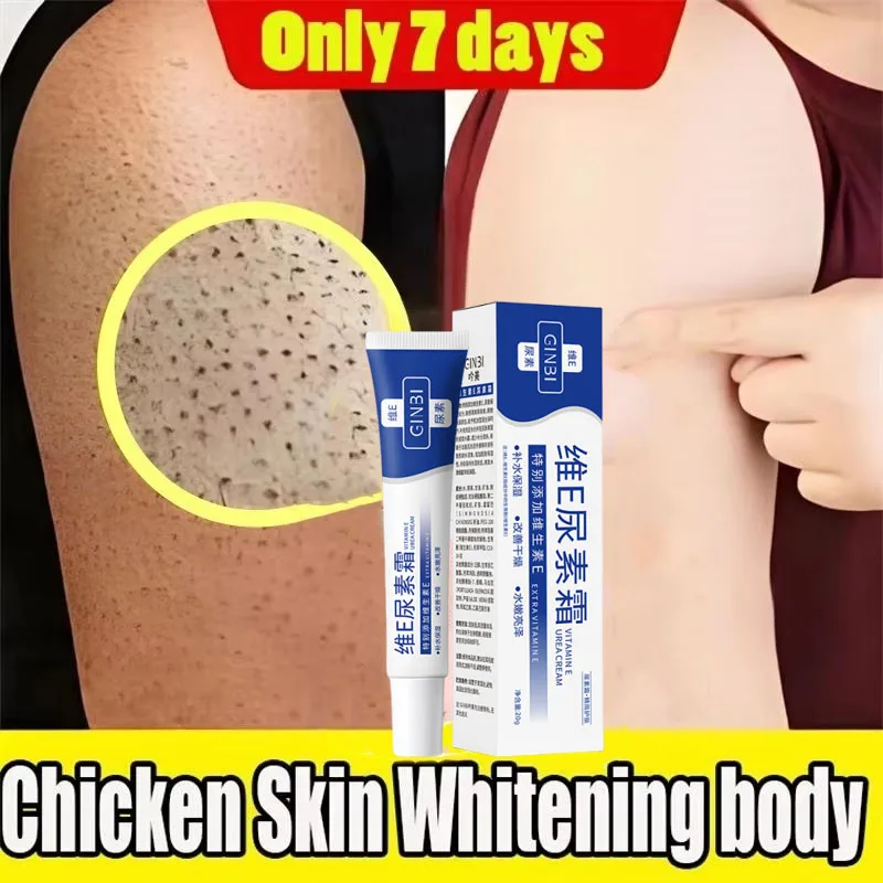

Keratosis Pilaris Repair Treatment Cream Exfoliating Removal Chicken Skin Cleaning Acne Spots Moisturizing Smooth Body Skin Care
