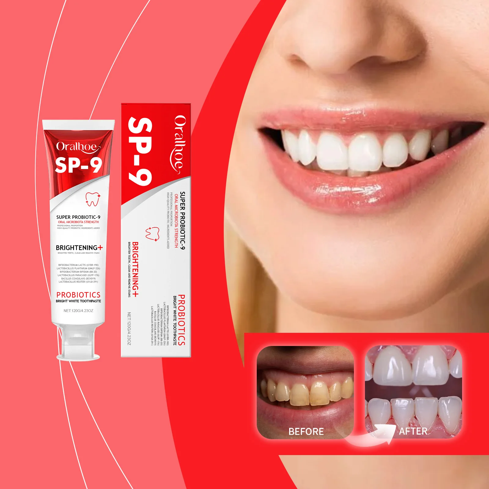 

SP-9 Probiotics Bright White Toothpaste Removes Plaque and Freshens Breath Mint Whitening Toothpaste for Intense Stain Removal