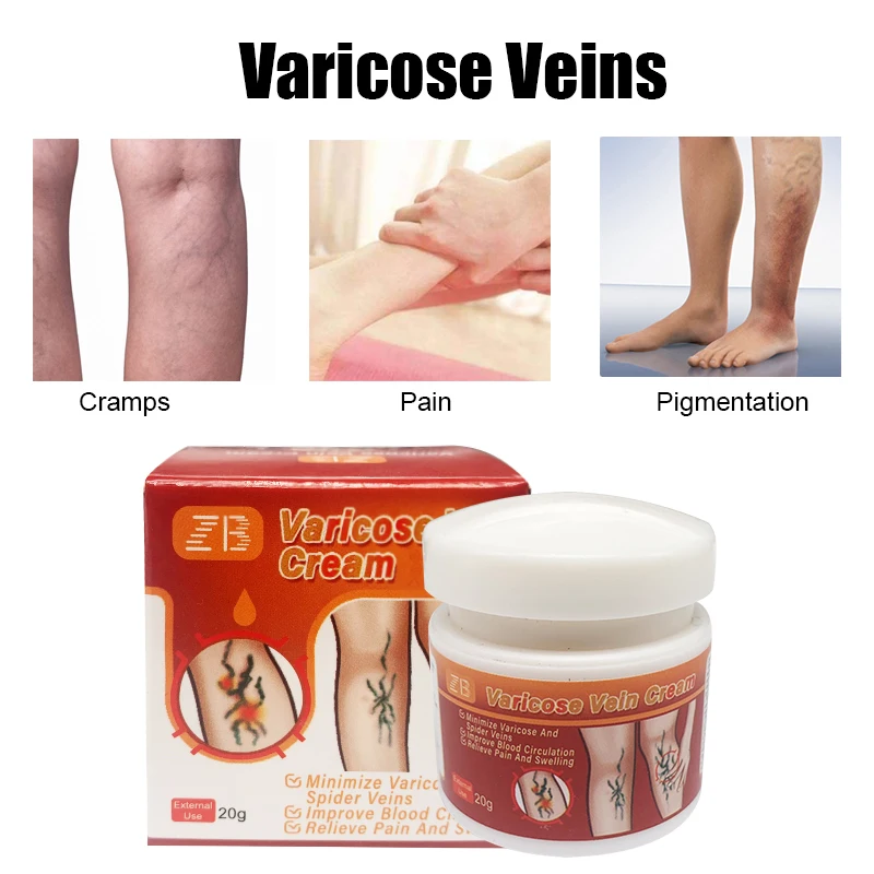 20g Varicose Veins Ointment Relief Pain Cream For Vasculitis Phlebitis Angiitis Tube  Relief Earthworms Leg Cream Skin Care