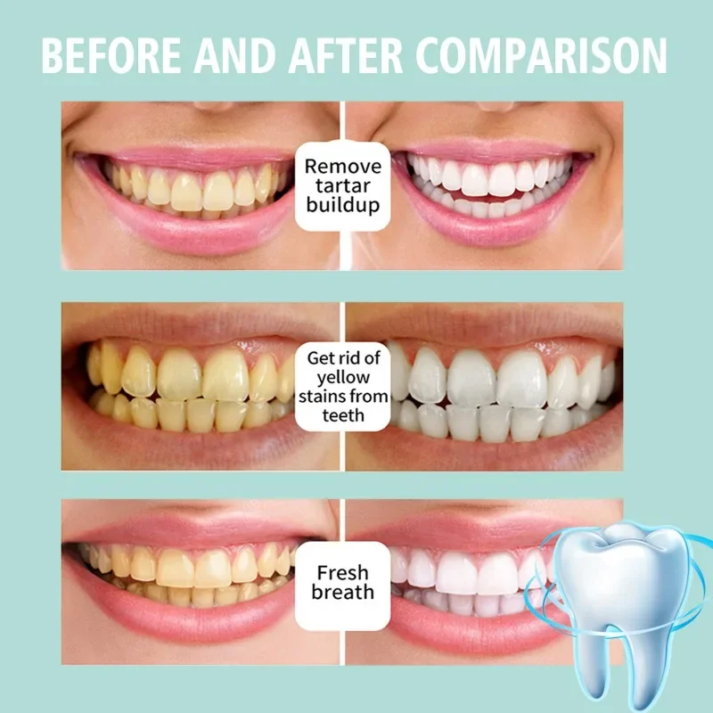 Отбеливающая зубная паста, свежие и яркие пятна от дыхания, удаление запаха зубов, предотвращение пародонтита