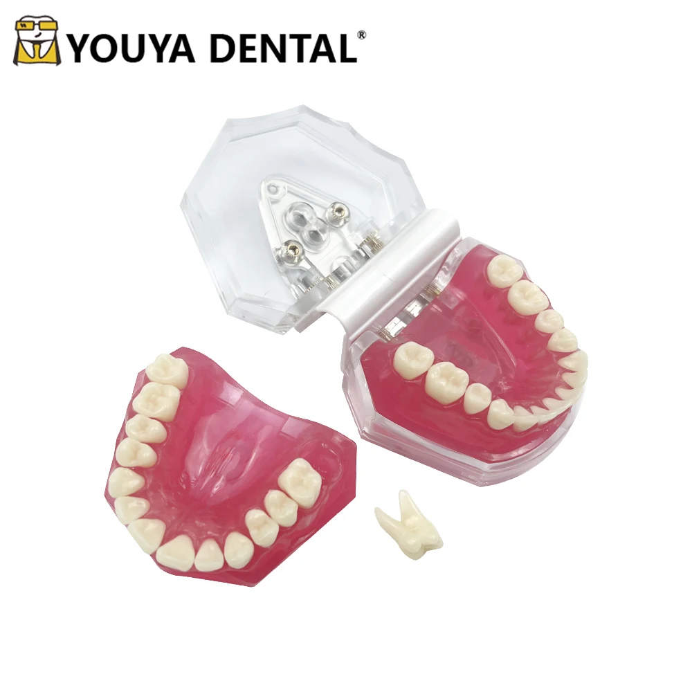 Dental Model 28Pcs Removable Teeth Model Detachable Implant Dentist Teaching Research Fit Standard Soft Rubber Simulation Cheek