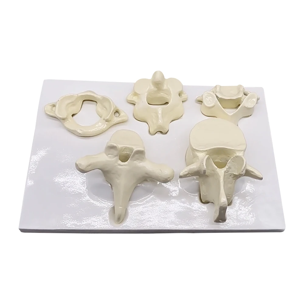 Enlarged Models of the Atlantoaxial Cervical Thoracic and Lumbar Vertebrae As Well As Joint Models of the Lumbar Vertebrae